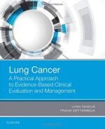 Lung Cancer: A Practical Approach to Evidence-Based Clinical Evaluation and Management