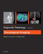 Grainger & Allison`s Diagnostic Radiology: Oncological Imaging