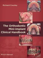 The Orthodontic Mini-implant Clinical Handbook
