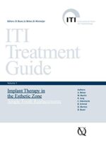 ITI Treatment Guide: Implant Therapy in the Esthetic Zone - Single-tooth Replacements v. 1